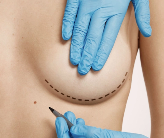 Breast Reduction