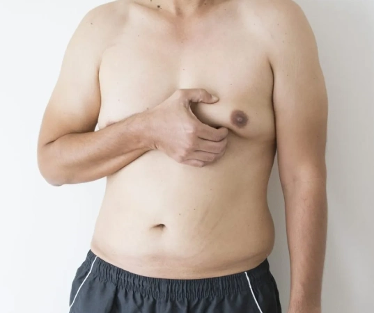 gynecomastia man boob